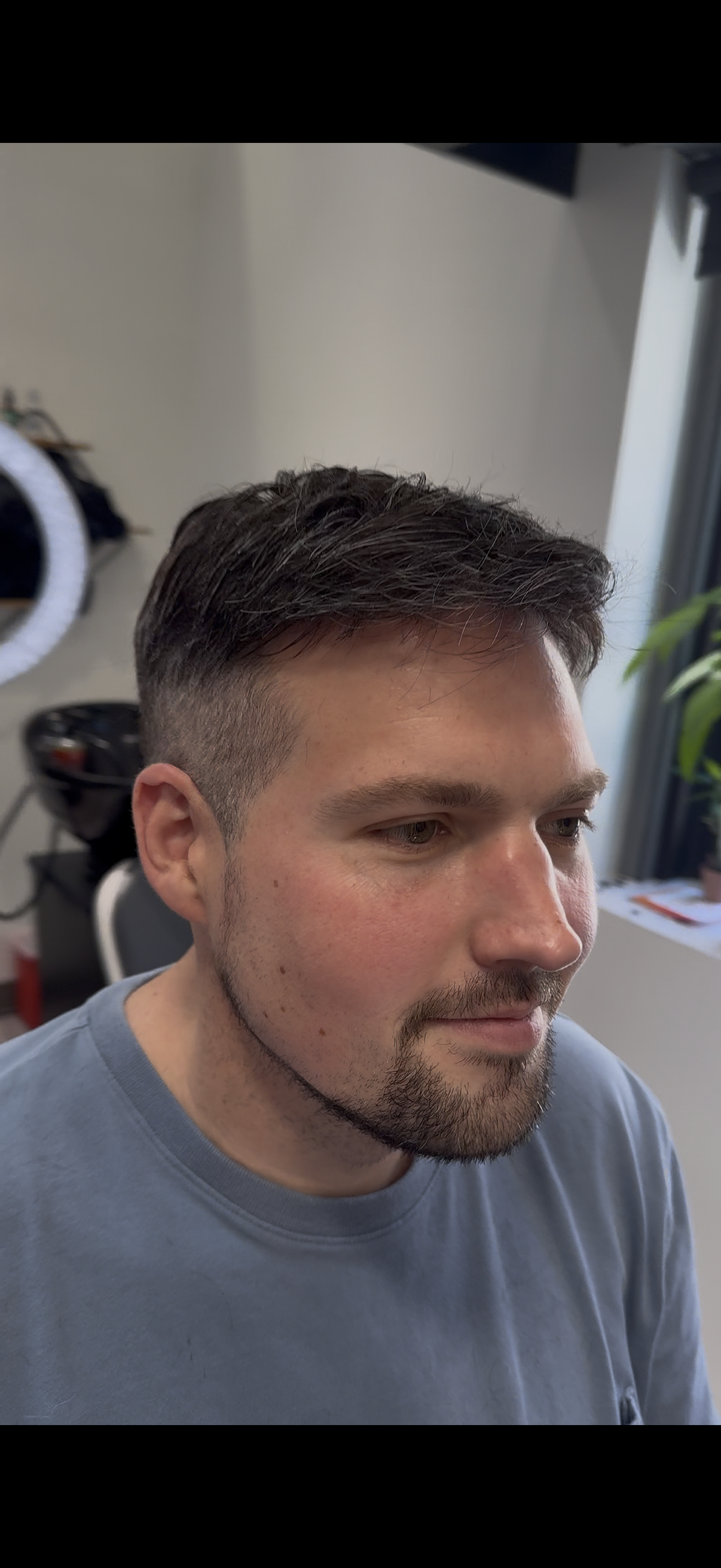 Hair replacement transformation result