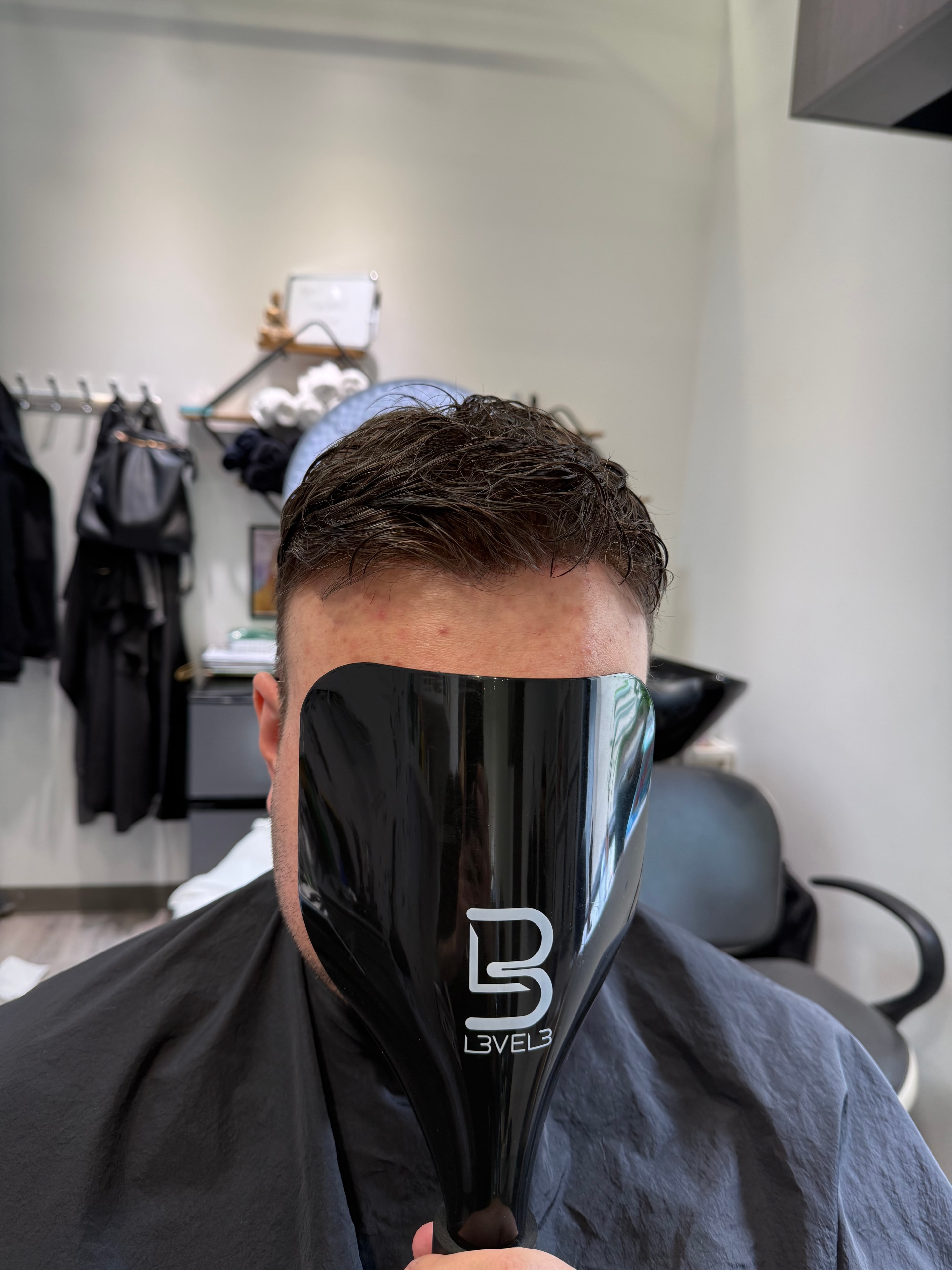 Hair replacement transformation result