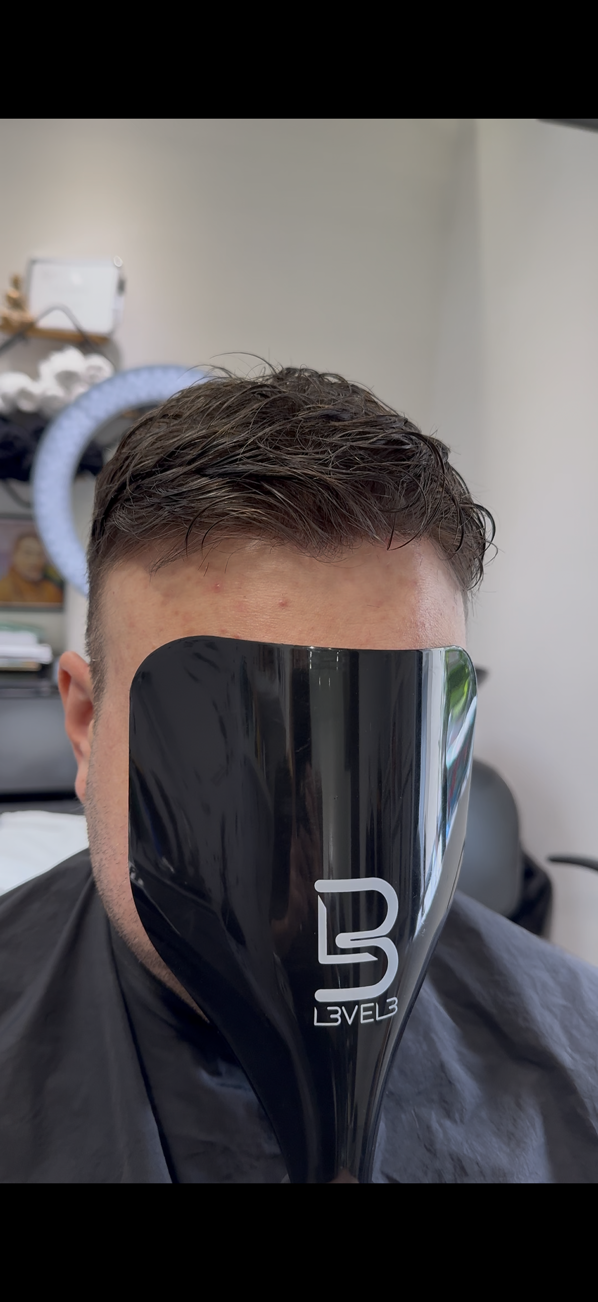 Confident man after hair replacement transformation